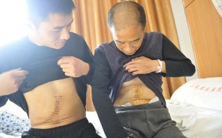 女性养肝护肝自测（护肝养肝就要这样做）